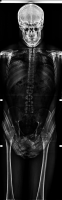 X-ray Bashful Skelton S.Laurent