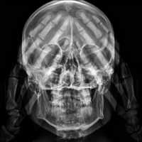 X Ray see nothing wrong S.Laurent